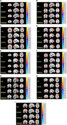 Resting-state brain network in Parkinson’s disease with different degrees of depression